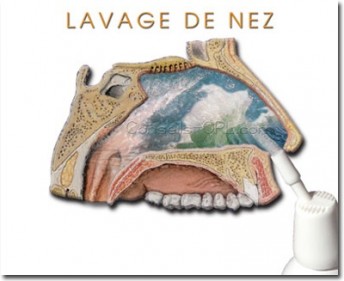 lavage_nez