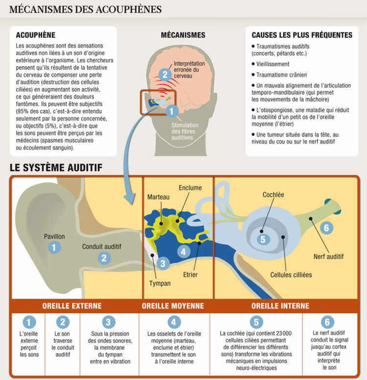 boucle neurophysio acouphene