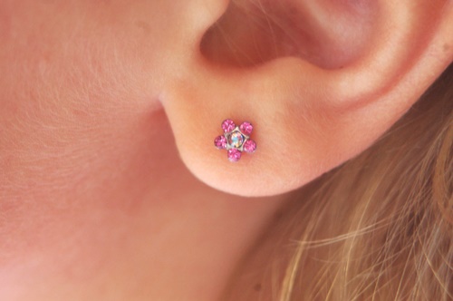 Eczema D Oreille