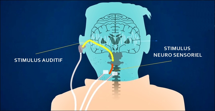 elfbar nachfll pod luft aus Cigarette lectronique double accu